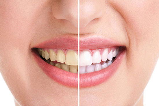 ارائه ۱۴ خدمت دندانپزشکی به بیماران خاص تحت پوشش بیمه سلامت خوزستان