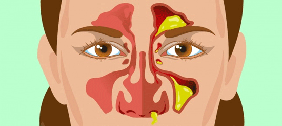 نکاتی که ترشحات بینی درباره سلامتی می‌گویند‌