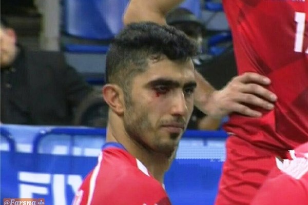 بازیکنان تیم ملی والیبال ایران چند بار یکدیگر را در بازی امشب مصدوم کردند